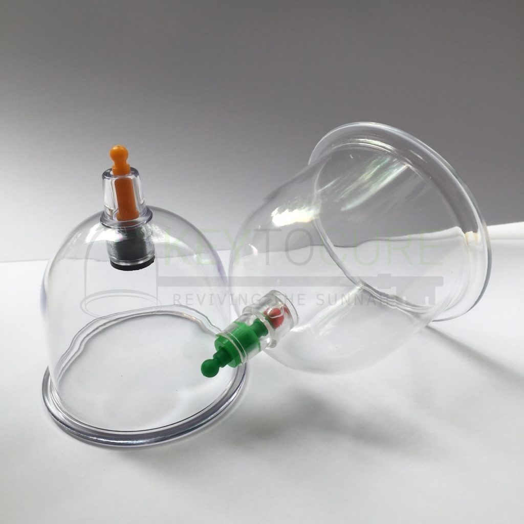 What Is Hijama Cupping Key To Cure